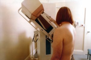 Breast screening rates low across Melton