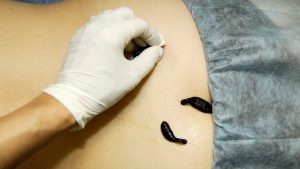 QUE SERA: The beauty and the leech