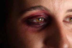 Family violence figures not the full story: council