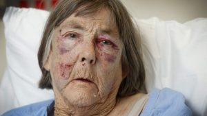 St Albans woman in hospital following car jacking